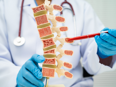 Spinal Fracture Surgery - Mindspine