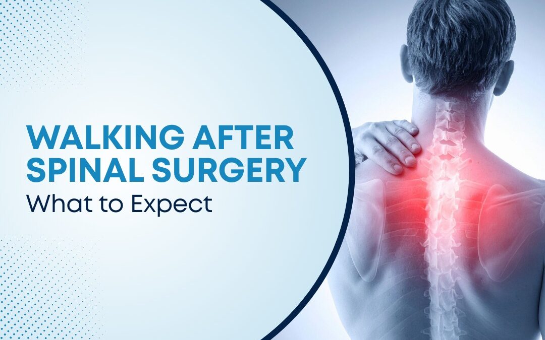 How Long Does It Take to Walk After Spinal Surgery?